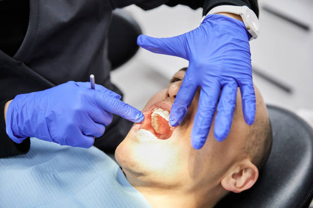 Best Chipped Tooth Repair Near Me  in Ashland, NE