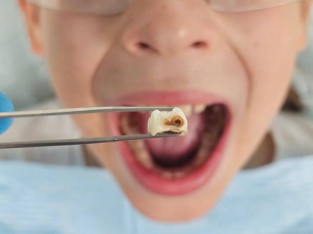 Best Emergency Tooth Extraction  in Ashland, NE